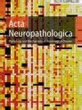 prada acta neuropathologica|acta neuropathologica reviews.